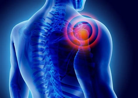 Shoulder Injury After A Car Accident Heres What To Know West Law Firm