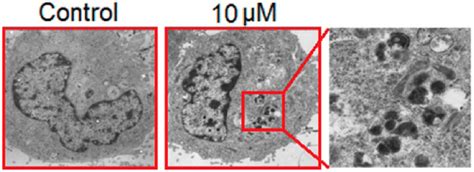 Tem Analysis Showing Induction Of Autophagy In Sk Hep1 Liver Cancer