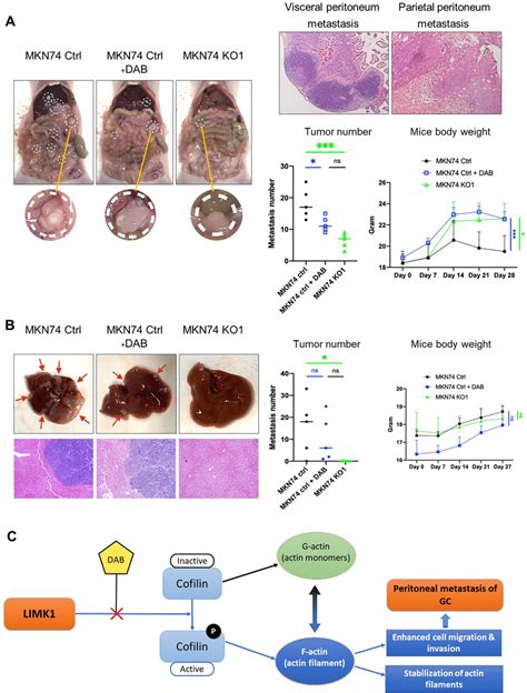 LIMK1 Knockout Or Dabrafenib DAB Treatment Reduced Peritoneal And