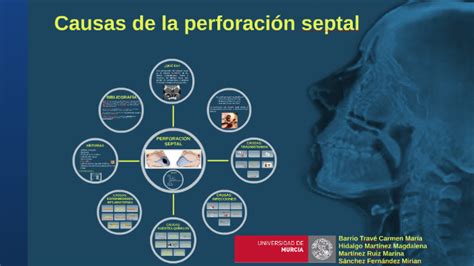 Perforaci N Septal By Mirian S Nchez Fern Ndez On Prezi