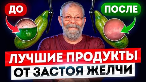 От застоя желчи спасёт 1 простой рецепт – лучшие продукты для желчи ...
