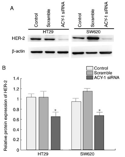 Impact Of Acy Sirna On Her Expression In Ht Or Sw Cells A