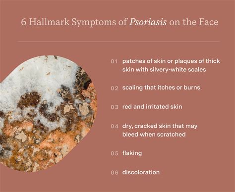 6 Hallmark Symptoms of Psoriasis on the Face