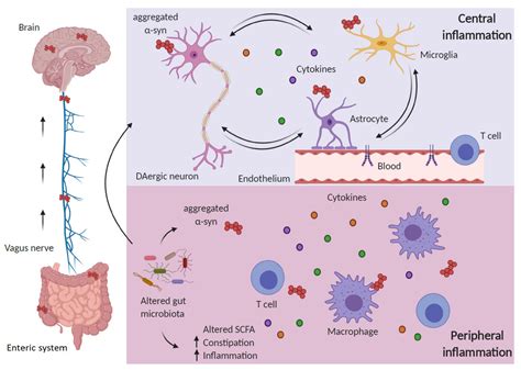 Cells Free Full Text Inflammation In Parkinsons Disease