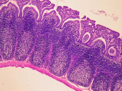 Histologia Tejido Linfoide