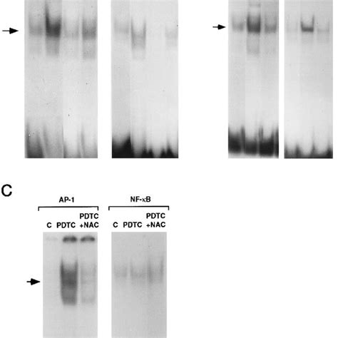 Induction Of Ap And Nf B Binding Activities By Tbhq Bha And Pdtc