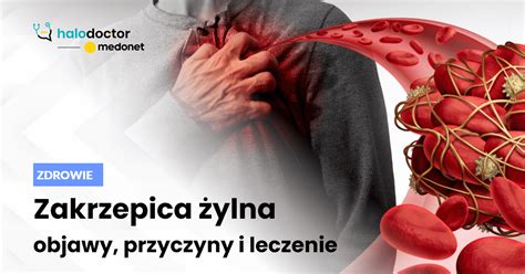 Zakrzepica Ylna Objawy Przyczyny I Leczenie