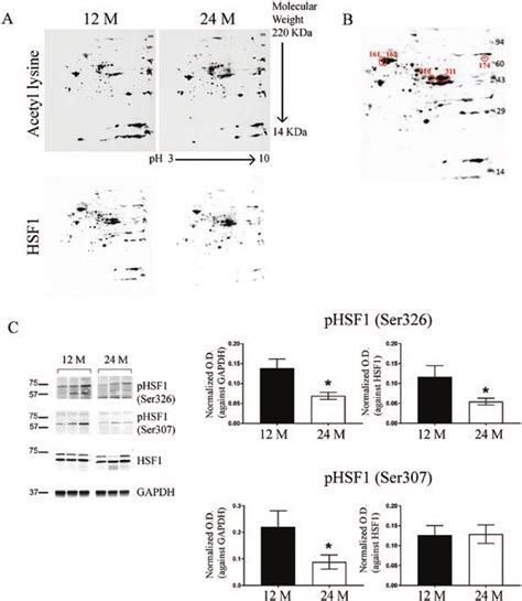 Posttranslational Modification Of Hsf1 With Age A Western Blot