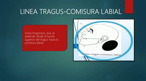 Tecnicas Radiograficas Intrabucales Ppt