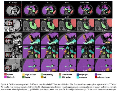 WACV 2022UNETR用于 3D 医学图像分割的Transformerresearch contributions 知乎