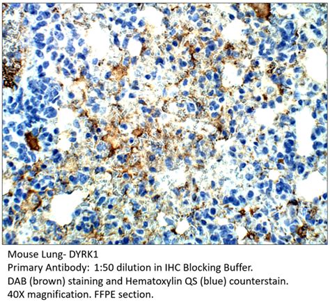 Polyclonal Dyrk1a Antibody MyBioSource