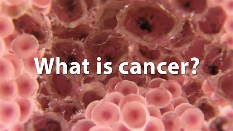 What Is Cancer What Causes Cancer And How Is It Treated Update