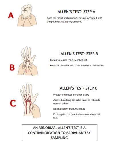 Arterial Blood Gas Sampling Flashcards | Quizlet