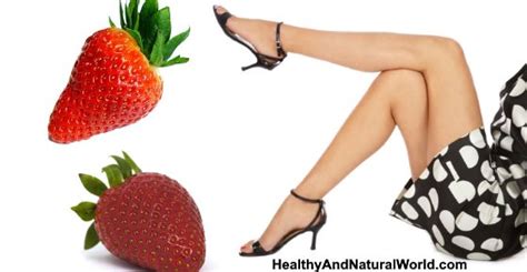 Strawberry Legs Causes And Effective Treatments To Get Rid Of Them