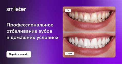 Набор для отбеливания зубов ️ Лучшие средства для отбеливания зубов в ...