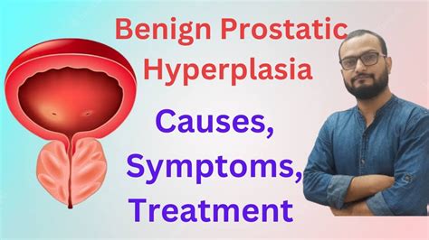 Benign Prostatic Hyperplasia Bph In Cause Symptoms Diagnosis And