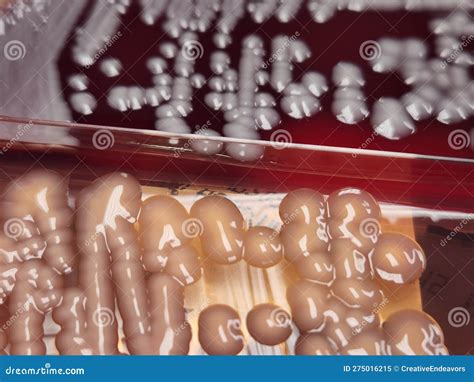 Klebsiella Pneumoniae Bacteria Growing On Blood And Macconkey Agar