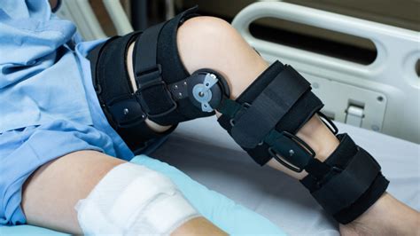 The Dark Side of Knee Braces: Potential Risks and Drawbacks