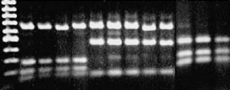 Alu I Restriction Enzyme Analysis Of Amplified Fragments Of The