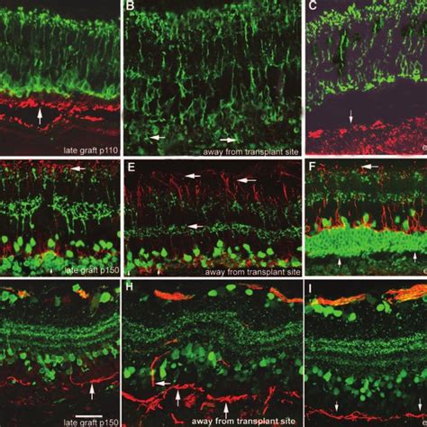 Dystrophic RCS Retinal Sections Stained With Cresyl Violet