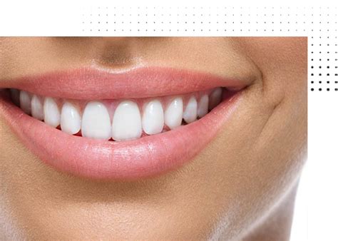 Smile Designing In Pune Shivaji Nagar Teeth Whitening In Pune