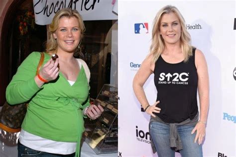 Alison Sweeney Weight Loss: Did She Opt For Plastic Surgery