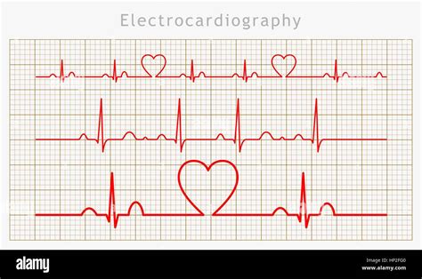 Vector De Electrocardiograma Vectores Fotografías E Imágenes De Alta Resolución Alamy