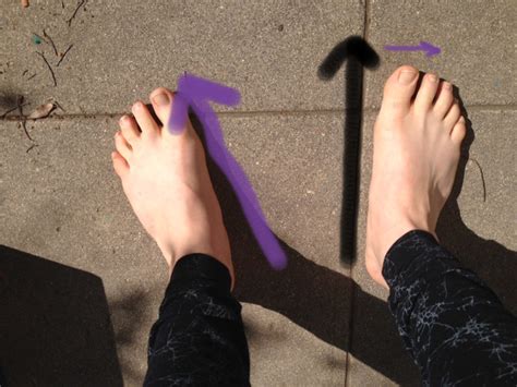 I Turn Out My Feet So Now What — Musicians Health Collective