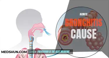 Is Acute Viral Bronchitis Contagious Understanding The Spread Of The