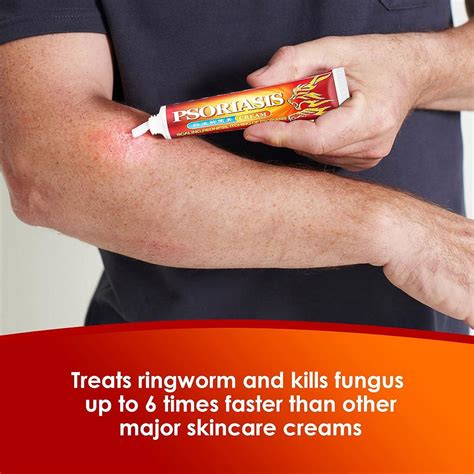 rashes cure home 7