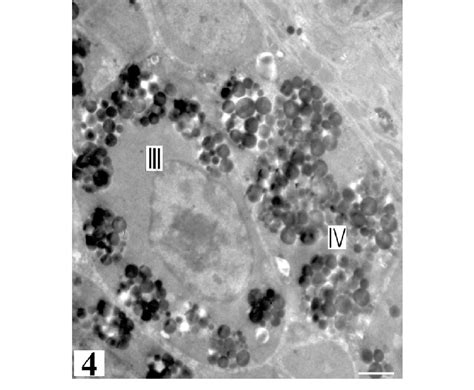 Vitelline follicles showing four consecutive stages of vitellogenesis ...