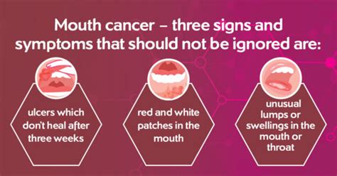 Mouth And Throat Cancers Thamesvalleycanceralliancenhsuk