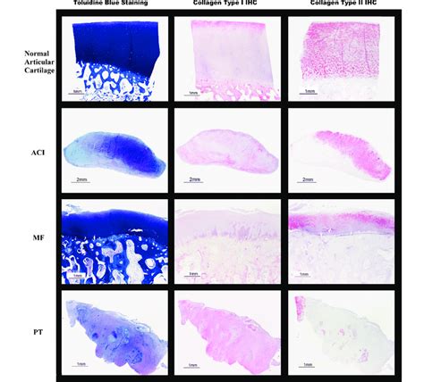 Histologic And Immunohistochemical Staining Of Representative Sections Download Scientific