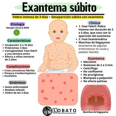 Exantema súbito Roséola Sexta enfermedad Exantemas Pediatría