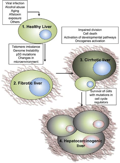 Model For The Development Of Primary Liver Tumors Several Risk And Download Scientific Diagram