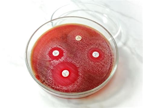 Premium Photo Antimicrobial Susceptibility Testing In Petri Dish