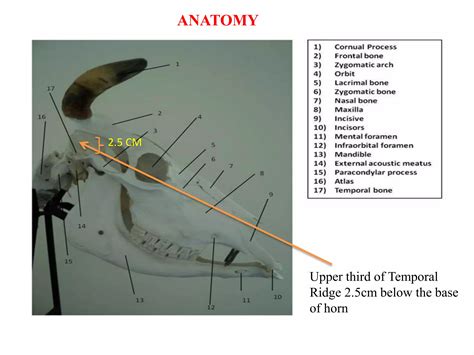 Local anesthesia techniques | PPT