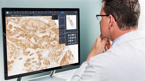 Roche Digital Pathology Launch Improves Speed Performance And