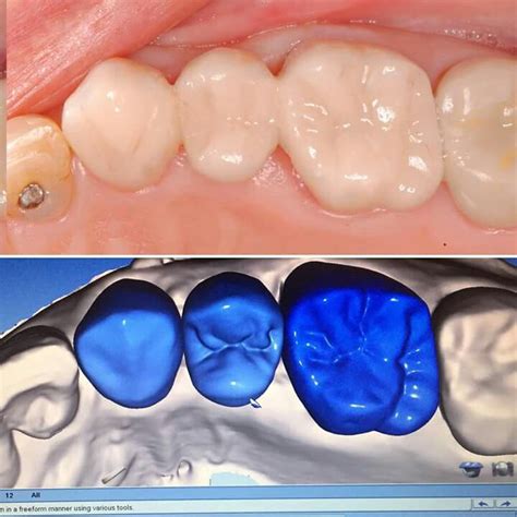 Pin by Amy Izquierdo on Odontología Dental anatomy Dentistry Dental