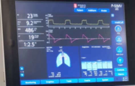 Mechanical Ventilation Critical Care Practitioner