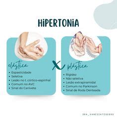 Pin by Vanessa Teodoro on Diferença de hipertonia elástica e plástica