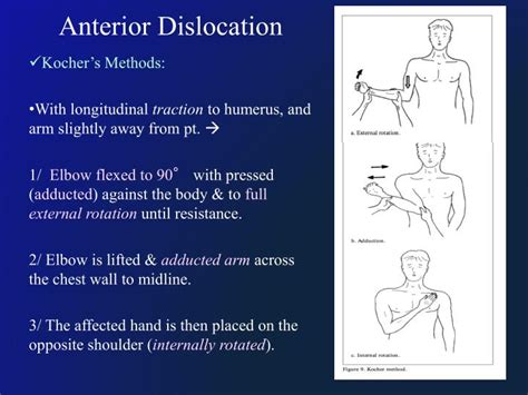 Ppt Shoulder Dislocation Powerpoint Presentation Id4841498