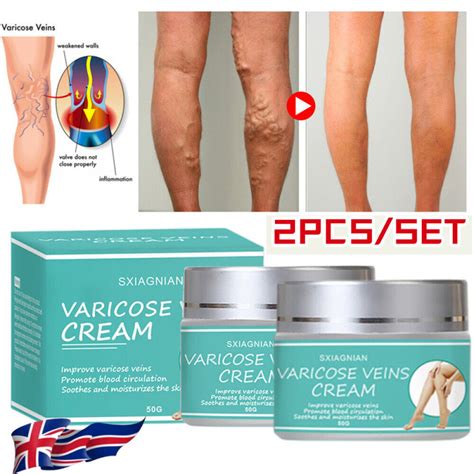 2x Varicose Veins Miracle Ointment Cream Relief Pain Vasculitis Phlebitis Gel Uk Ebay