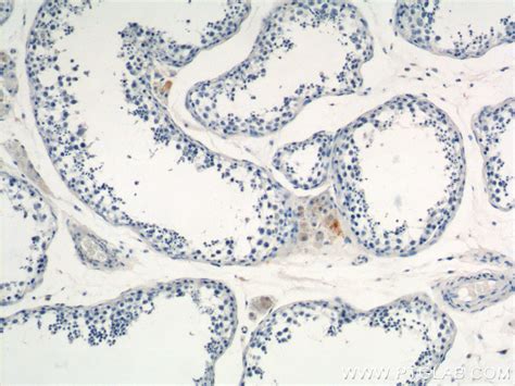 Mark Antibody Ap Proteintech