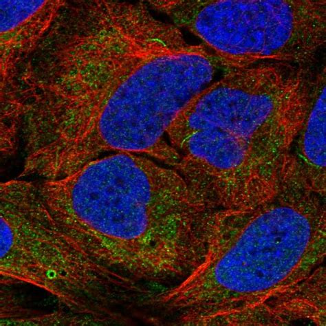 Rabbit Polyclonal Anti Agpat1 Antibody Buy For Research Highly