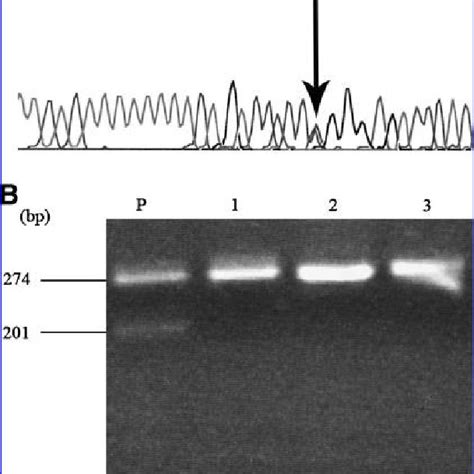 Analysis of the PTEN gene mutation. (A) Forward sequence of IVS5 and... | Download High ...