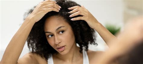 Dry Scalp Symptoms Causes And Home Remedies