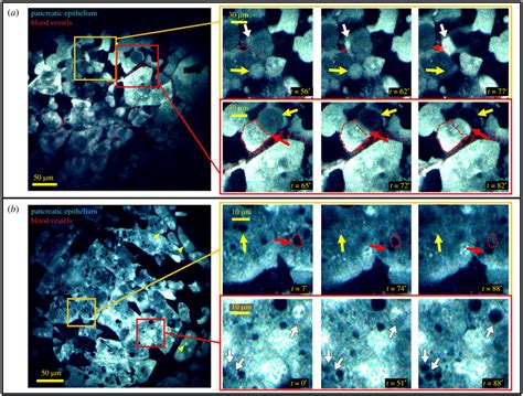 cellular  subcellular dynamics  healthy pancreas