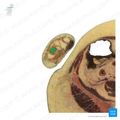 Capitate bone: anatomy and structure | Kenhub