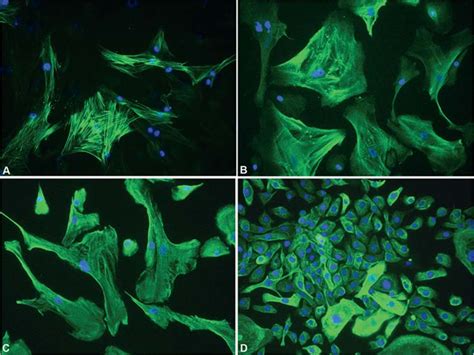 Characterization Of Myoepithelial Cells From PA Immunostaining For